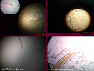 Adult Female hookworm
Adult Male hookworm
 