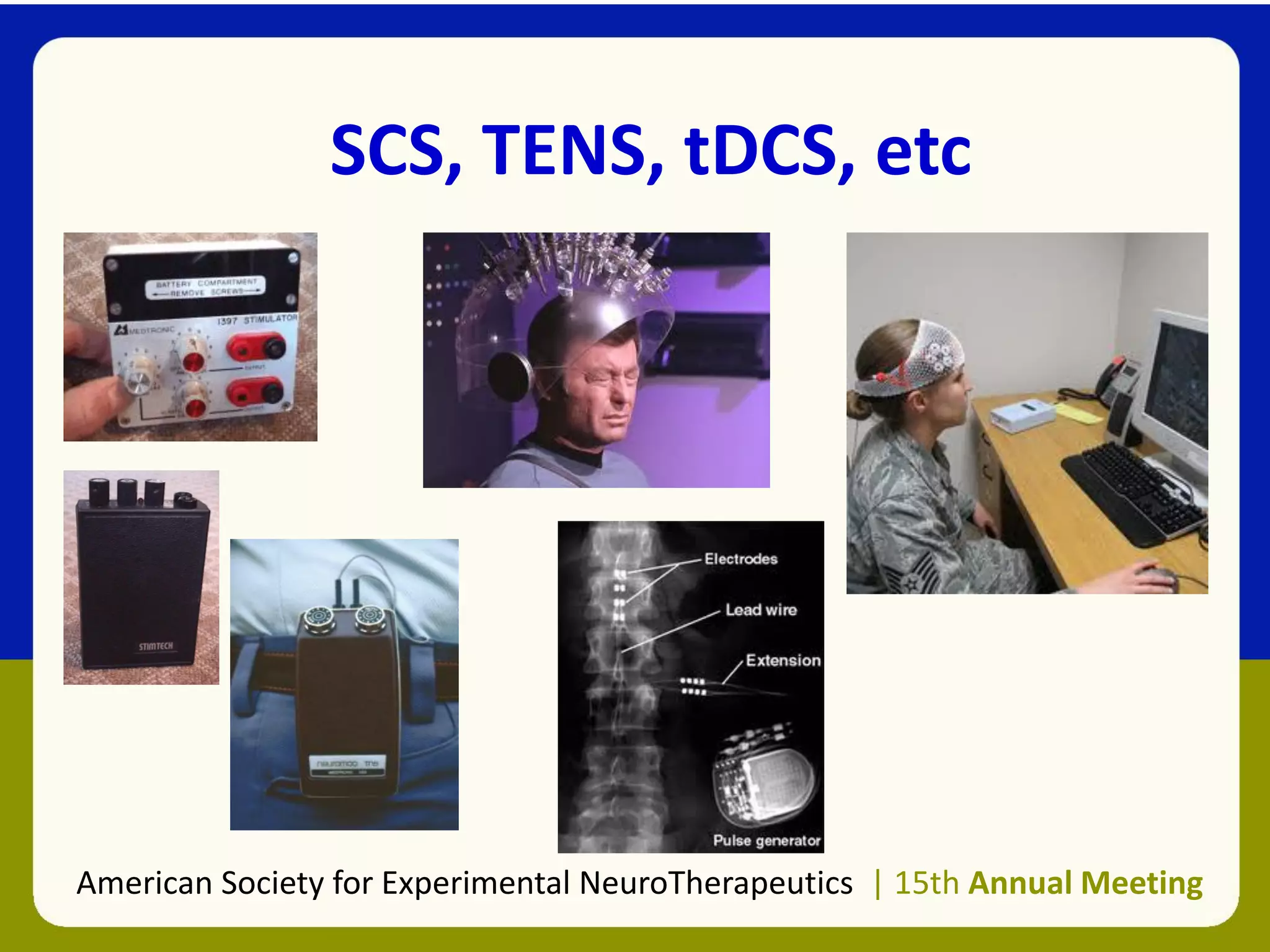 SCS, TENS, tDCS, etc
American Society for Experimental NeuroTherapeutics | 15th Annual Meeting
 