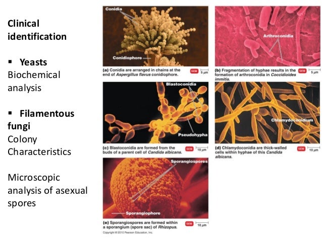 9 bio265 viruses, fungi, protozoa, helminths instructor dr di bonaven…