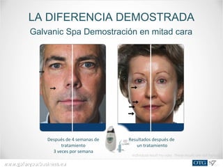 www.goforyourbusiness.euwww.goforyourbusiness.eu
Después de 4 semanas de
tratamiento
3 veces por semana
LA DIFERENCIA DEMOSTRADA
Individual result my vary. These results are not typical.
Galvanic Spa Demostración en mitad cara
Resultados después de
un tratamiento
 
