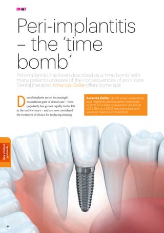 Keyclinical
protocols
64
Peri-implantitis
– the ‘time
bomb’Peri-implantitis has been described as a ‘time bomb’ with
many patients unaware of the consequences of poor care.
Dental therapist Amanda Gallie offers some tips
Amanda Gallie has 20 years’ experience
as a hygienist and became a therapist
in 2012 on a tutor conversion course at
KCH. She is a BADT representaive and
works in practice in Stamford.
ental implants are an increasingly
mainstream part of dental care – their
popularity has grown rapidly in the UK
in the last few years – and are now considered
the treatment of choice for replacing missing
D
 