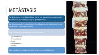 METÁSTASIS
Se diseminan por vía linfática hacia los ganglios obturadores y
finalmente, hacia los ganglios paraaórticos.
La diseminación hematógena tiene lugar principalmente hacia
los huesos (esqueleto axial).
Afectando principalmente, en ese orden:
•Columna lumbar
•Fémur proximal
•Pélvis
•Columna torácica
•Costillas
Las metástasis óseas son típicamente osteoblásticas.
 
