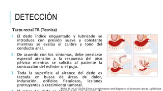 DETECCIÓN
Tacto rectal TR (Tecnica)
1. El dedo índice enguantado y lubricado se
introduce con presión suave y constante
mientras se evalúa el calibre y tono del
conducto anal.
2. De acuerdo con los síntomas, debe prestarse
especial atención a la respuesta del piso
pélvico mientras se solicita al paciente la
contracción del esfínter o el pujo.
3. Toda la superficie al alcance del dedo es
tactada en busca de áreas de dolor,
induración, orificios fistulosos, lesiones
protruyentes o crecimiento tumoral.
Philip W. et al. (2020) Clinical presentation and diagnosis of prostate cancer. UpToDate.
 