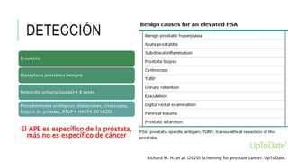DETECCIÓN
El APE es específico de la próstata,
más no es específico de cáncer
Prostatitis
Hiperplasia prostática benigna
Retención urinaria (sonda) 8 veces
Procedimientos urológicos: dilataciones, cistoscopia,
biopsia de próstata, RTUP HASTA 50 VECES
Richard M. H. et al. (2020) Screening for prostate cancer. UpToDate.
 