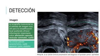 DETECCIÓN
Imagen
La ecografía transrectal es
el método de imagen mas
útil para la estadificación
local pudiendo ofrecer
información importante
sobre afectación capsular,
vesículas seminales, cuello
vesical o recto.
No existe patrón
característico, suele
aparecer como nódulos
hiperecogénicos.
Philip W. et al. (2020) Clinical presentation and diagnosis of prostate cancer. UpToDate.
 