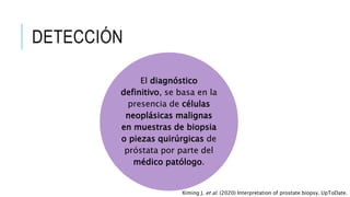 DETECCIÓN
El diagnóstico
definitivo, se basa en la
presencia de células
neoplásicas malignas
en muestras de biopsia
o piezas quirúrgicas de
próstata por parte del
médico patólogo.
Ximing J. et al. (2020) Interpretation of prostate biopsy. UpToDate.
 
