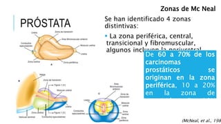 Órgano retroperitoneal
con peso aproximado de
20g que rodea el cuello de
la vejiga y la uretra, carece
de una capsula
diferenciada.
PRÓSTATA
Zonas de Mc Neal
Se han identificado 4 zonas
distintivas:
 La zona periférica, central,
transicional y fibromuscular,
algunos incluyen la periuretral.
(McNeal, et al., 1988
De 60 a 70% de los
carcinomas
prostáticos se
originan en la zona
periférica, 10 a 20%
en la zona de
transición y 5 a 10%
en la zona central.
 
