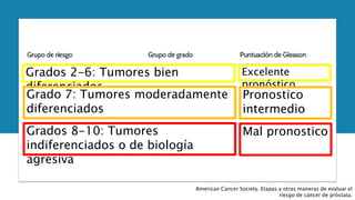 American Cancer Society. Etapas y otras maneras de evaluar el
riesgo de cáncer de próstata.
Grados 2-6: Tumores bien
diferenciados
Grado 7: Tumores moderadamente
diferenciados
Grados 8-10: Tumores
indiferenciados o de biología
agresiva
Excelente
pronóstico
Pronostico
intermedio
Mal pronostico
 