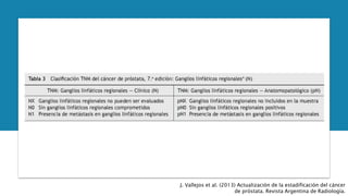 J. Vallejos et al. (2013) Actualización de la estadificación del cáncer
de próstata. Revista Argentina de Radiología.
 