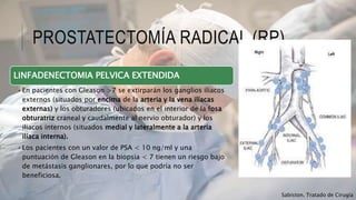PROSTATECTOMÍA RADICAL (RP)
LINFADENECTOMIA PELVICA EXTENDIDA
•En pacientes con Gleason >7 se extirparán los ganglios iliacos
externos (situados por encima de la arteria y la vena ilíacas
externas) y los obturadores (ubicados en el interior de la fosa
obturatriz craneal y caudalmente al nervio obturador) y los
iliacos internos (situados medial y lateralmente a la arteria
ilíaca interna).
•Los pacientes con un valor de PSA < 10 ng/ml y una
puntuación de Gleason en la biopsia < 7 tienen un riesgo bajo
de metástasis ganglionares, por lo que podría no ser
beneficiosa.
Sabiston. Tratado de Cirugía
 