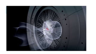 GAMMA KNIFE
Alta SVLP
El estadiaje es poco confiable ya que no obtiene la
pieza quirúrgica para su examen anatomopatológico
Indicado en pacientes con altas comorbilidades y no
candidatos a PR.
 