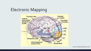Electronic Mapping
www.mybrainnotes.com
 