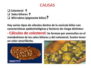  Colesterol
 Sales biliares
 Bilirrubina (pigmento biliar)

Hay varios tipos de cálculos dentro de la vesícula biliar con
características epidemiológicas y factores de riesgo distintos:
- Cálculos de colesterol: Se forman por anomalías en el
metabolismo de las sales biliares y del colesterol. Suelen tener
un color amarillento.
 