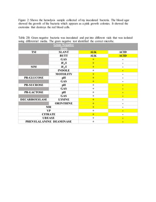 Figure 2: Shows the hemolysis sample collected of my inoculated bacteria. The blood agar
showed the growth of the bacteria which appears as a pink growth colonies. It showed the
exotoxins that destroys the red blood cells.
Table 2B: Gram negative bacteria was inoculated and put into different vials that was isolated
using differential media. The gram negative test identified the correct microbe.
Gram Negative
Tests
TSI SLANT ALK ACID
BUTT ALK ACID
GAS + -
𝑯 𝟐 𝑺 + -
SIM 𝑯 𝟐 𝑺 + -
INDOLE + -
MOTOLITY + -
PR-GLUCOSE pH + -
GAS + -
PR-SUCROSE pH + -
GAS + -
PR-LACTOSE pH + -
GAS + -
DECARBOXYLASE LYSINE + -
ORINTHINE + -
MR + -
VP + -
CITRATE + -
UREASE + -
PHENYLALANINE DEAMINASE + -
 