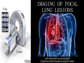 IMAGING OF FOCAL
LUNG LESIONS
DR SAKHER-ALKHADERI
CONSULTANT RADIOLOGISTAMC
 