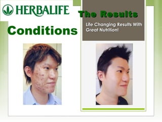 Conditions 
TThhee RReessuullttss 
LLiiffee CChhaannggiinngg RReessuullttss WWiitthh 
GGrreeaatt NNuuttrriittiioonn!! 
 