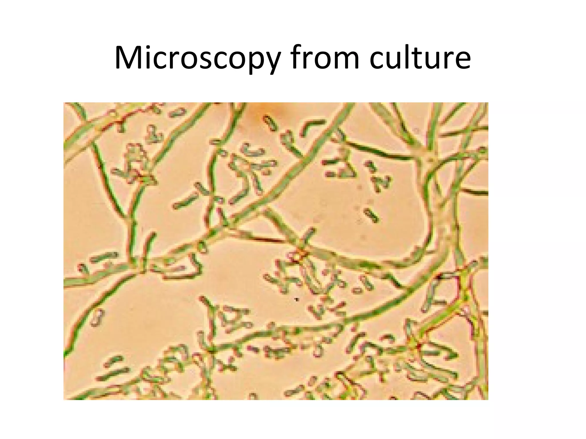 Microscopy from culture
 