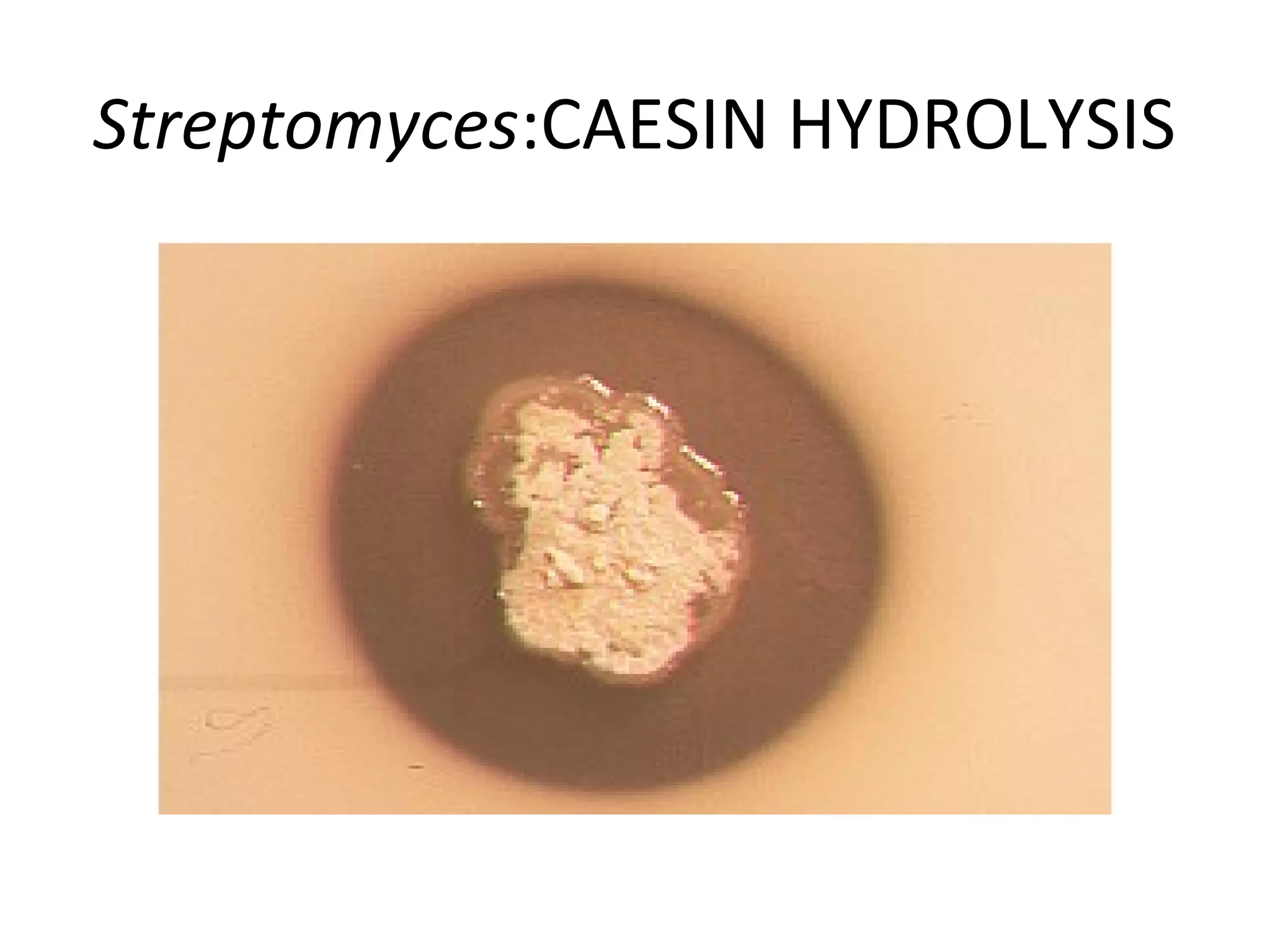 Streptomyces:CAESIN HYDROLYSIS
 