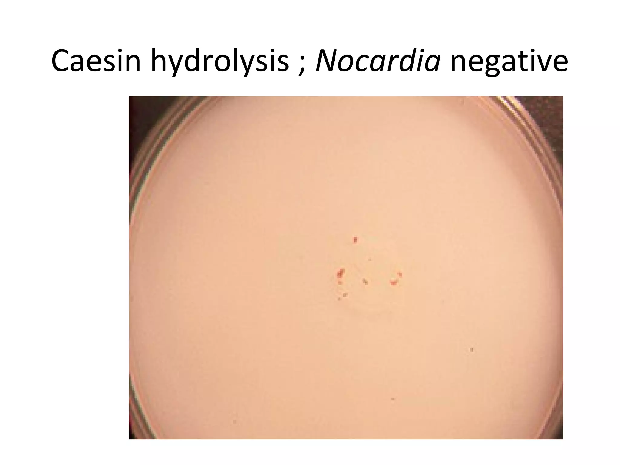 Caesin hydrolysis ; Nocardia negative
 
