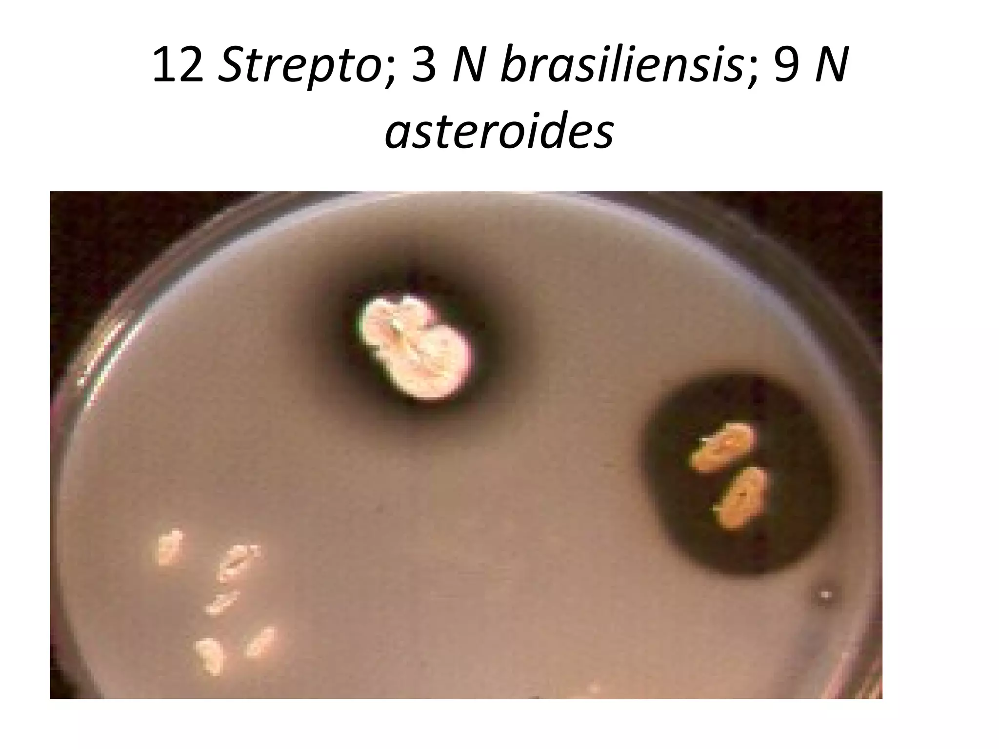 12 Strepto; 3 N brasiliensis; 9 N
asteroides
 