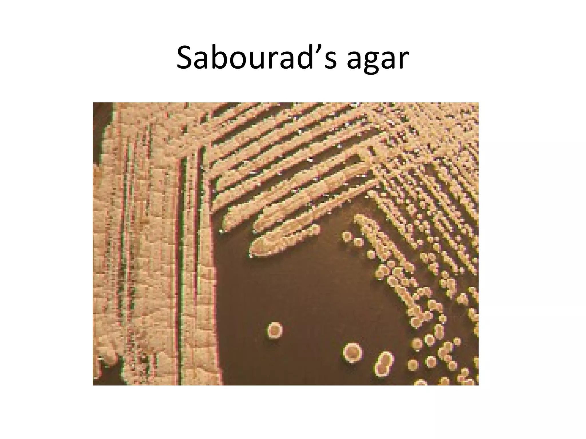 Sabourad’s agar
 