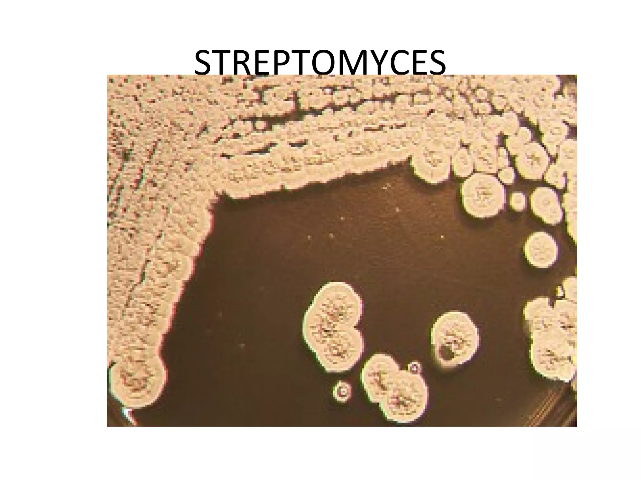 STREPTOMYCES
 