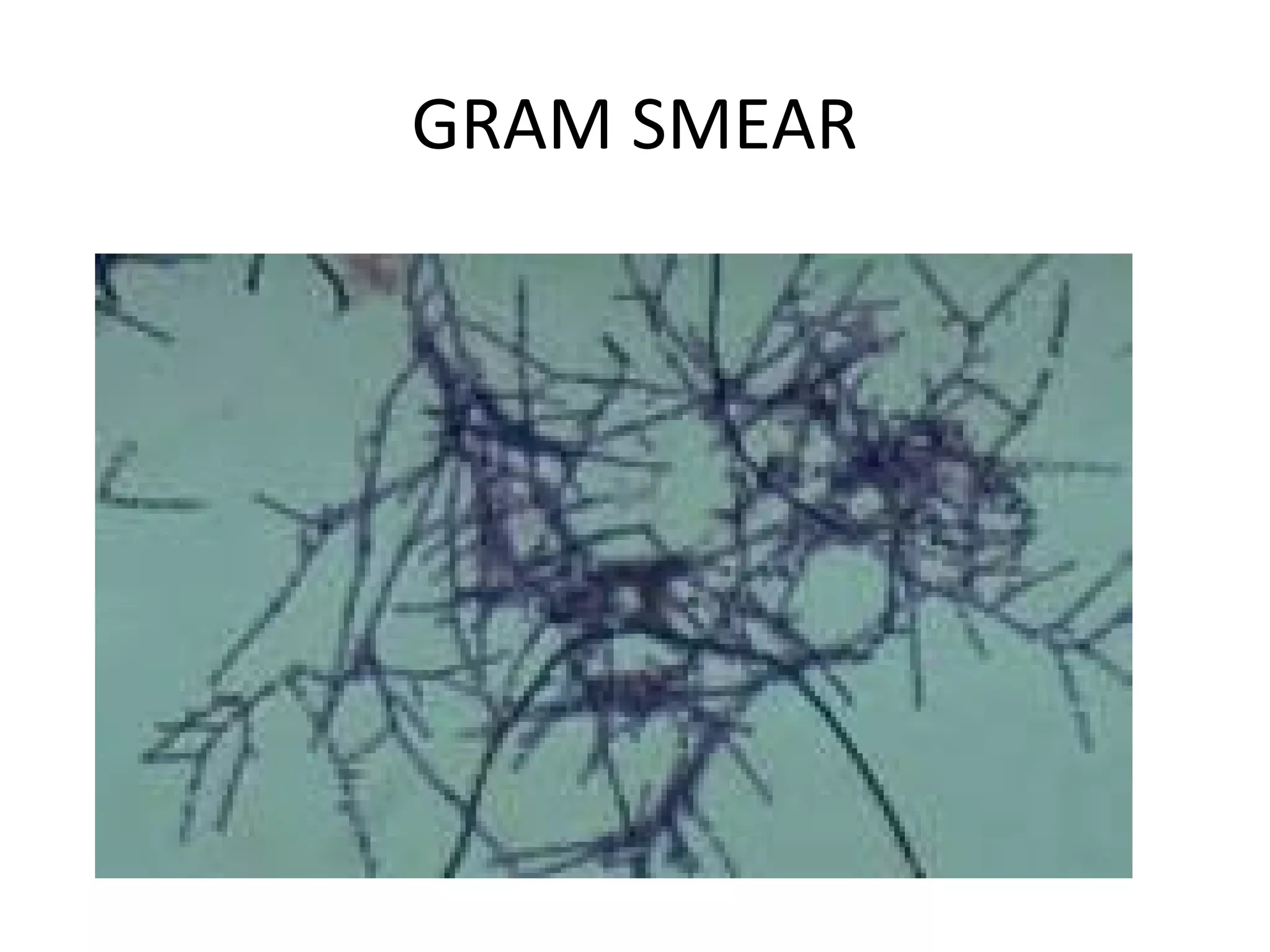 GRAM SMEAR
 