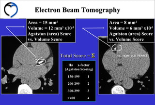 Electron Beam TomographyElectron Beam Tomography
Hn x-factor
(Agatston Scoring)
130-199 1
200-299 2
300-399 3
>400 4
Area = 15 mmArea = 15 mm22
Volume = 12 mmVolume = 12 mm33
x10x10-3-3
Agatston (area) ScoreAgatston (area) Score
vs. Volume Scorevs. Volume Score
Area = 8 mmArea = 8 mm22
Volume = 6 mmVolume = 6 mm33
x10x10-3-3
Agatston (area) ScoreAgatston (area) Score
vs. Volume Scorevs. Volume Score
Total Score =Total Score = ΣΣ
 