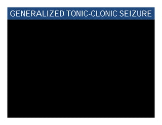 GENERALIZED TONIC-CLONIC SEIZURE
 