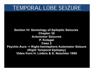 TEMPORAL LOBE SEIZURE
 