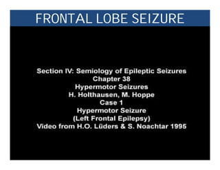 FRONTAL LOBE SEIZURE
 