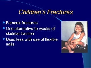 Children’s FracturesChildren’s Fractures
Femoral fracturesFemoral fractures
One alternative to weeks ofOne alternative to weeks of
skeletal tractionskeletal traction
Used less with use of flexibleUsed less with use of flexible
nailsnails
 