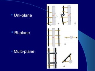 • Uni-plane
• Bi-plane
• Multi-plane
 