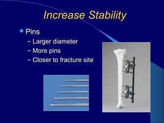 Increase StabilityIncrease Stability
PinsPins
– Larger diameterLarger diameter
– More pinsMore pins
– Closer to fracture siteCloser to fracture site
 