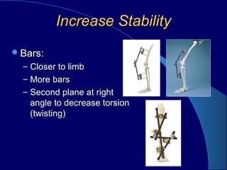 Increase StabilityIncrease Stability
Bars:Bars:
– Closer to limbCloser to limb
– More barsMore bars
– Second plane at rightSecond plane at right
angle to decrease torsionangle to decrease torsion
(twisting)(twisting)
 
