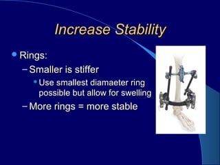 Increase StabilityIncrease Stability
Rings:Rings:
– Smaller is stifferSmaller is stiffer
Use smallest diamaeter ringUse smallest diamaeter ring
possible but allow for swellingpossible but allow for swelling
– More rings = more stableMore rings = more stable
 