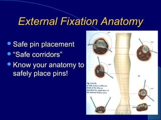 External Fixation AnatomyExternal Fixation Anatomy
Safe pin placementSafe pin placement
““Safe corridors”Safe corridors”
Know your anatomy toKnow your anatomy to
safely place pins!safely place pins!
 
