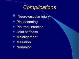 ComplicationsComplications
 Neurovascular injuryNeurovascular injury
 Pin looseningPin loosening
 Pin tract infectionPin tract infection
 Joint stiffnessJoint stiffness
 MalalignmentMalalignment
 MalunionMalunion
 NonunionNonunion
 