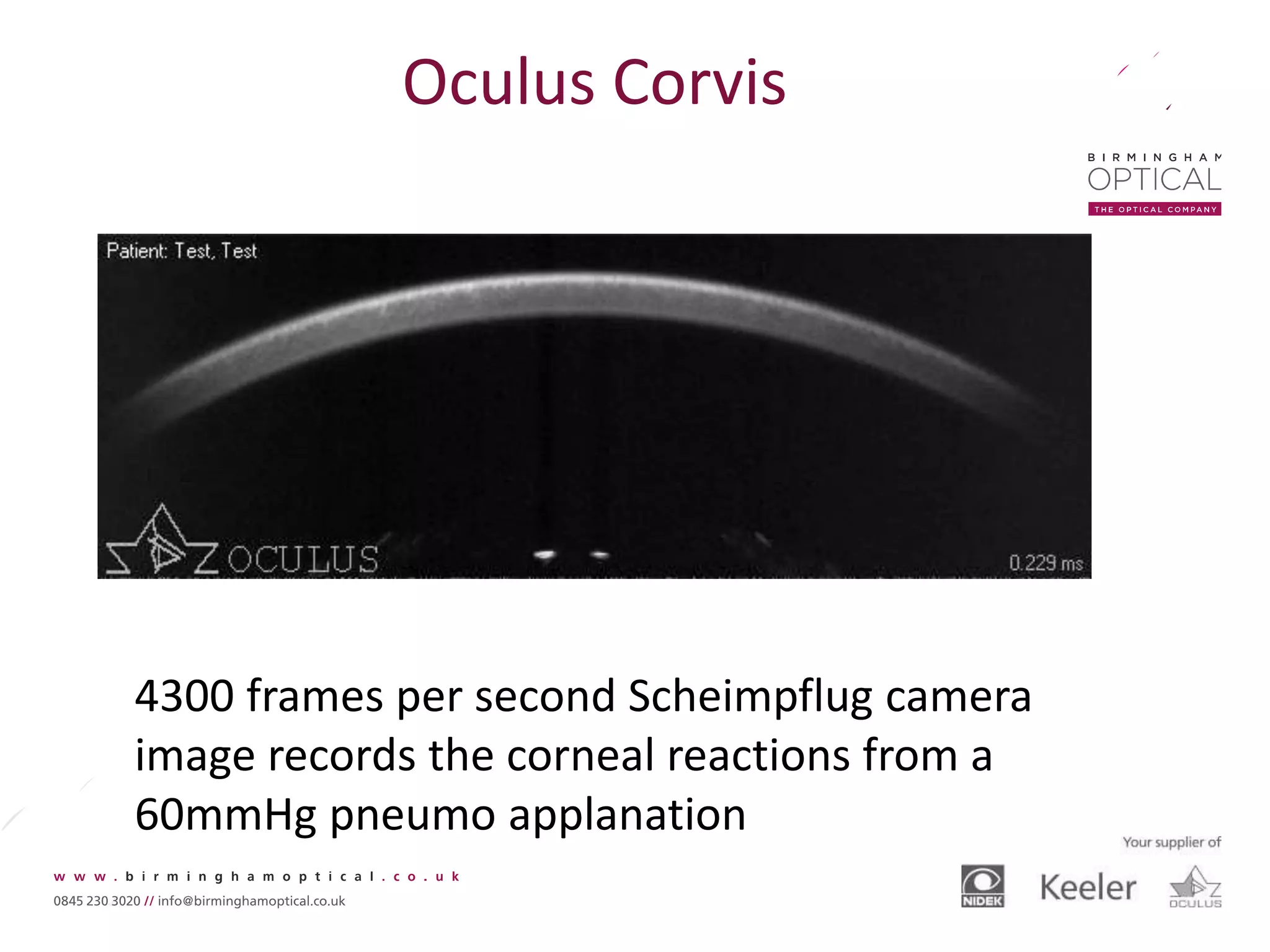 Oculus Corvis
4300 frames per second Scheimpflug camera
image records the corneal reactions from a
60mmHg pneumo applanation
 