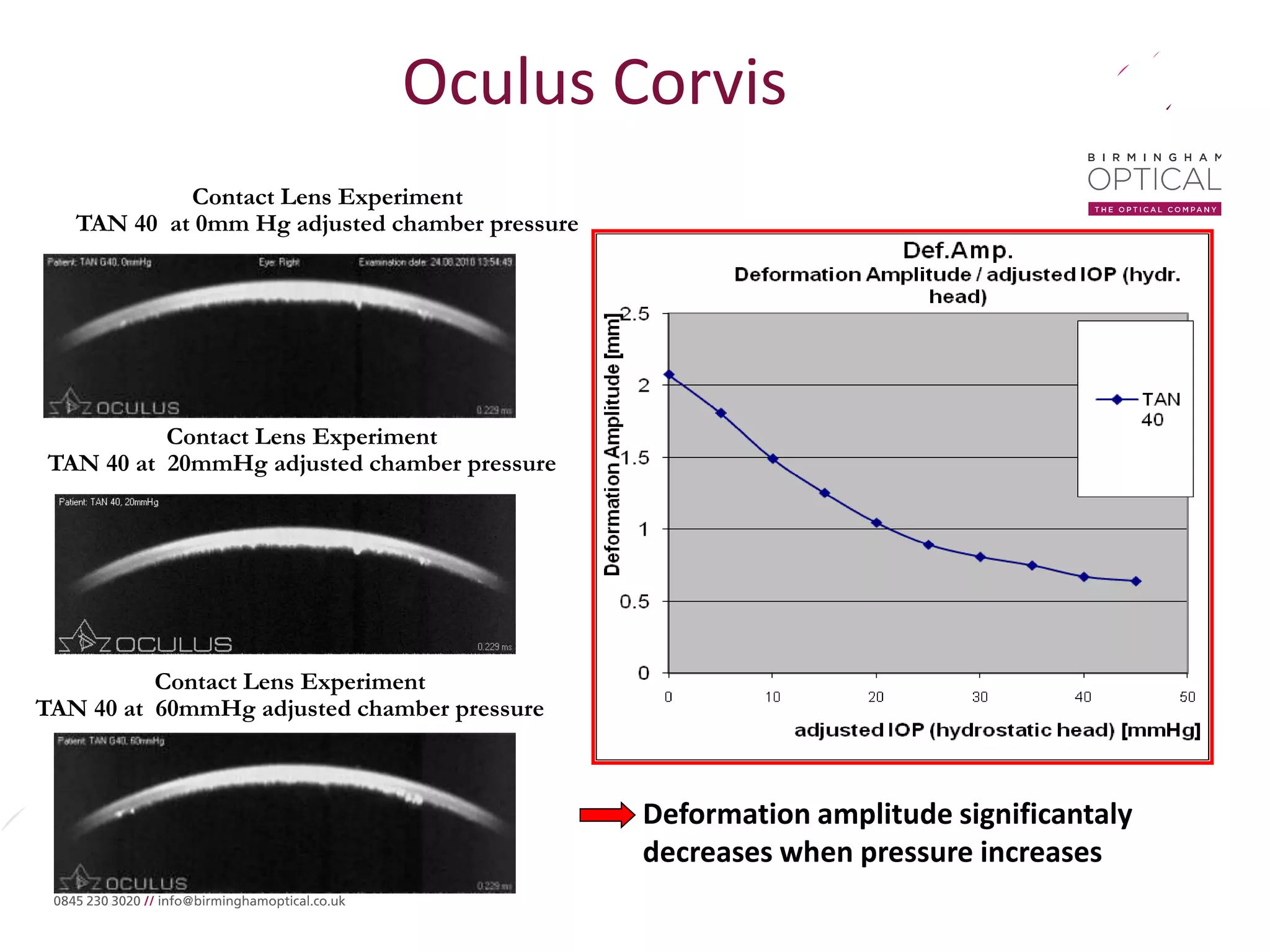Oculus Corvis
Contact Lens Experiment
TAN 40 at 0mm Hg adjusted chamber pressure
Contact Lens Experiment
TAN 40 at 20mmHg adjusted chamber pressure
Contact Lens Experiment
TAN 40 at 60mmHg adjusted chamber pressure
Deformation amplitude significantaly
decreases when pressure increases
 