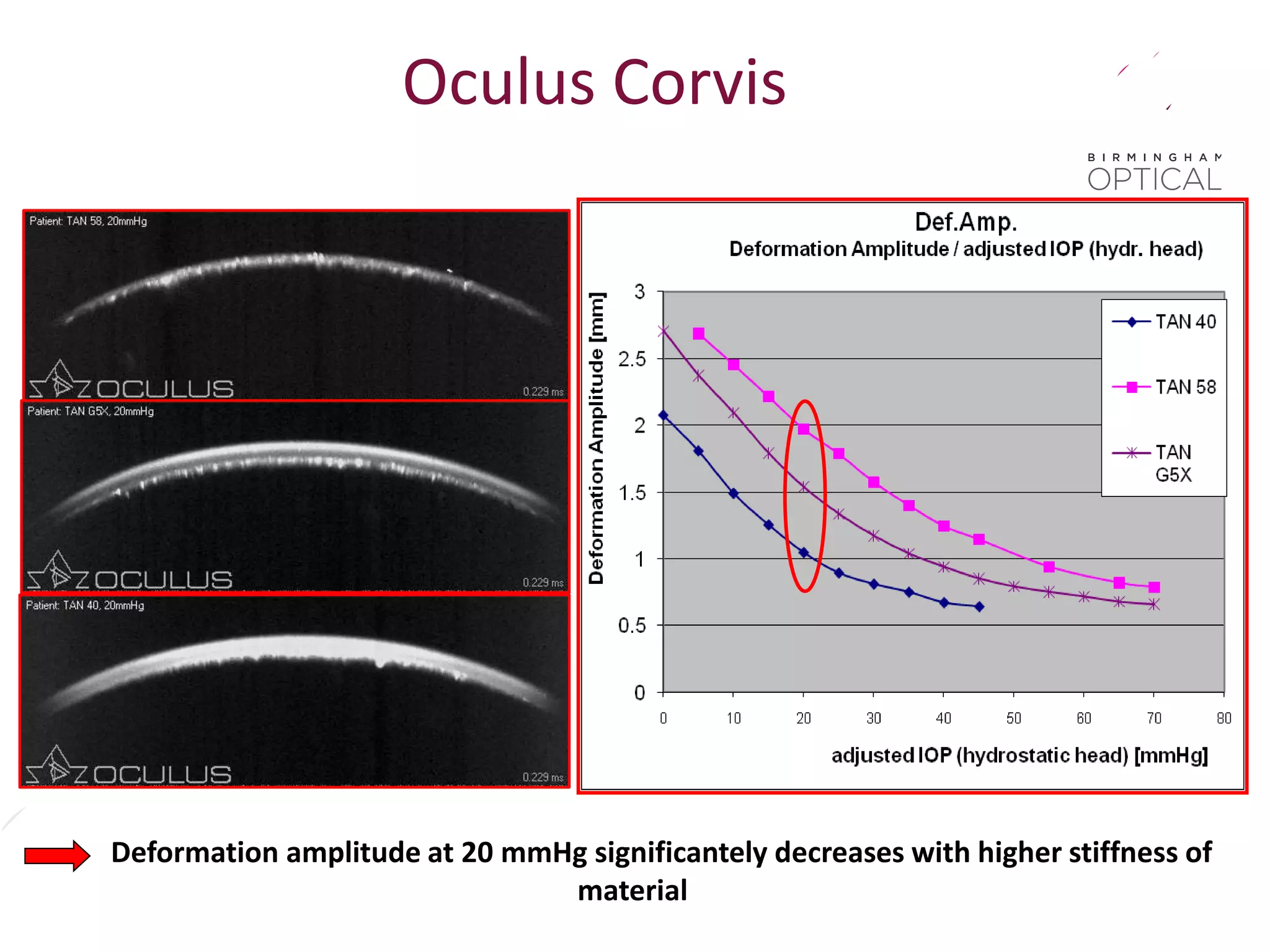Deformation amplitude at 20 mmHg significantely decreases with higher stiffness of
material
Oculus Corvis
 