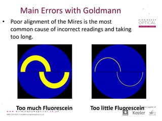 • Poor alignment of the Mires is the most
common cause of incorrect readings and taking
too long.
Too much Fluorescein Too little Fluorescein
Main Errors with Goldmann
 