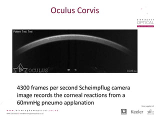 Oculus Corvis
4300 frames per second Scheimpflug camera
image records the corneal reactions from a
60mmHg pneumo applanation
 