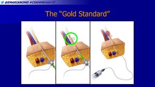 @EMARIANOMD #CSAHSWinter20
The “Gold Standard”
 