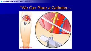 @EMARIANOMD #CSAHSWinter20
“We Can Place a Catheter…
© Mike Mariano
 