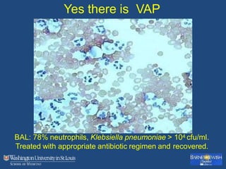 Yes there is VAP
BAL: 78% neutrophils, Klebsiella pneumoniae > 104 cfu/ml.
Treated with appropriate antibiotic regimen and recovered.
 