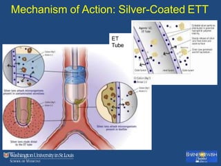 Mechanism of Action: Silver-Coated ETT
ET
Tube
 