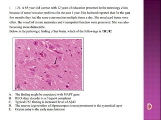 Alzheimer disease (test with answer until 2017)