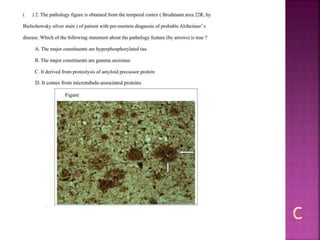 Alzheimer disease (test with answer until 2017)