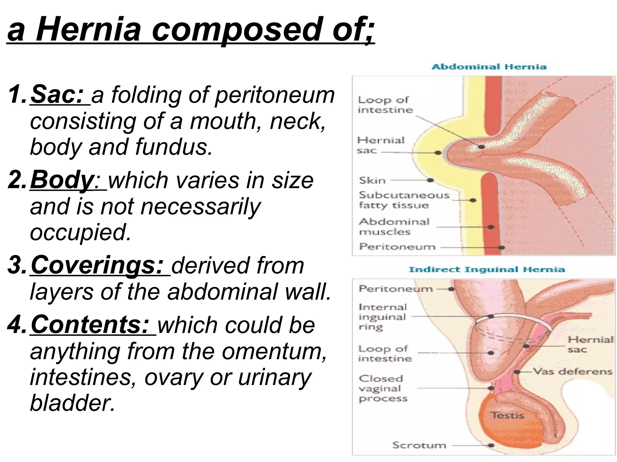 a Hernia composed of;
1.Sac: a folding of peritoneum
consisting of a mouth, neck,
body and fundus.
2.Body: which varies in size
and is not necessarily
occupied.
3.Coverings: derived from
layers of the abdominal wall.
4.Contents: which could be
anything from the omentum,
intestines, ovary or urinary
bladder.
 